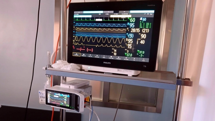 El Hospital de Antequera moderniza su UCI con un nuevo sistema de monitorizaci&oacute;n para pacientes cr&iacute;ticos